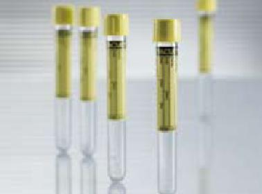 VACUETTE® Urinalysis Tube Plain 9.5 mL Pull Cap Polyethylene Terephthalate (PET) Tube (470580_BX)