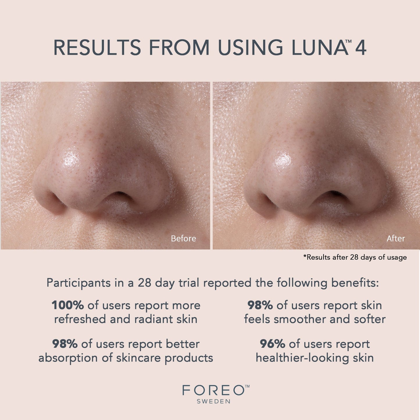 LUNA™ 4 Balanced Skin Facial Cleansing Brush and Massage Device LUNA™ 4 Balanced Skin (1244534_EA)