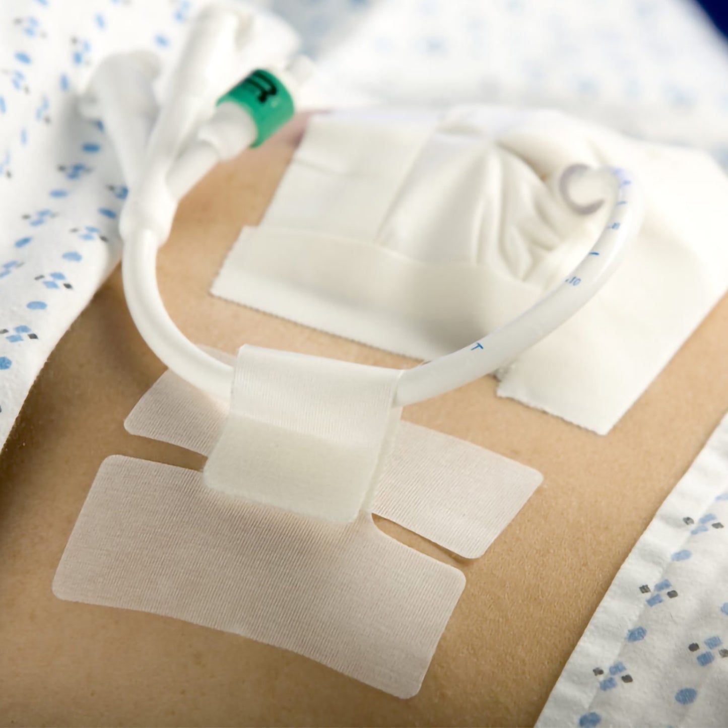 Cath-Secure™ Multi-Purpose Tube Securement Cath-Secure™ (1151849_EA)