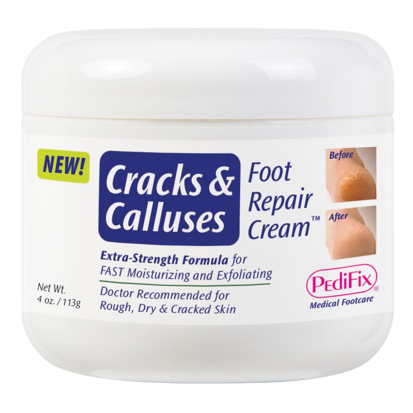 PediFix® Cracks & Calluses Foot Moisturizer 4 oz. Jar Scented Cream (1213206_EA)