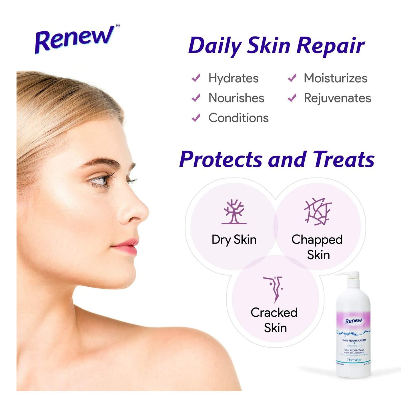 Renew™ Skin Repair Skin Protectant 4 oz. Tube Scented Cream (776335_EA)