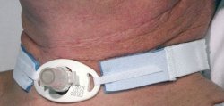 AirLife® Tracheostomy Tube Holder Neonate (724209_EA)