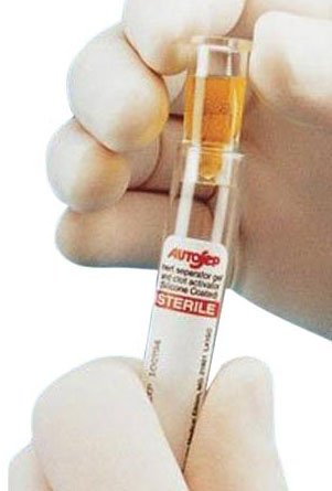 Monoject™ Ezee-Nest™ Sample Cup For 13 mm Collection Tubes (1118295_CS)