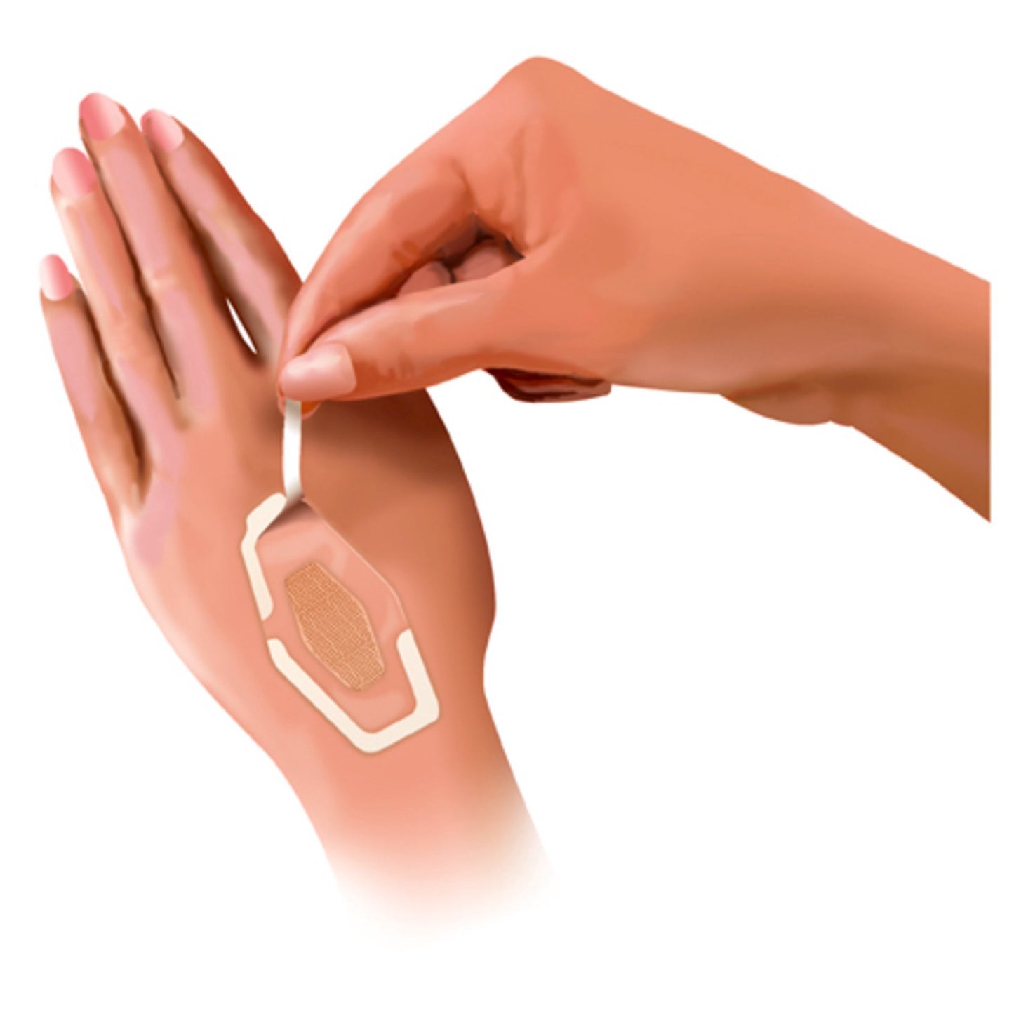 3M Nexcare™ Adhesive Strip 7/8 X 1-1/16 Inch / 1-1/4 X 2-1/2 Inch / 1-1/16 X 2-1/4 Inch Plastic Rectangle Sheer Sterile (723770_BX)