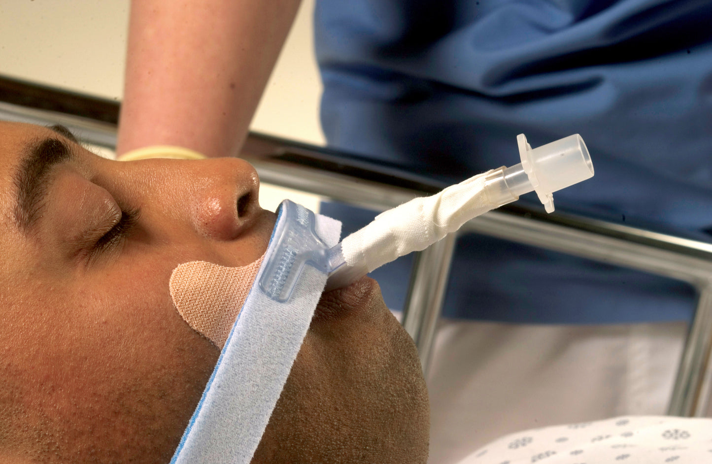 Stabilock™ Endotracheal Tube Holder 7mm to 10mm Adult (344536_EA)