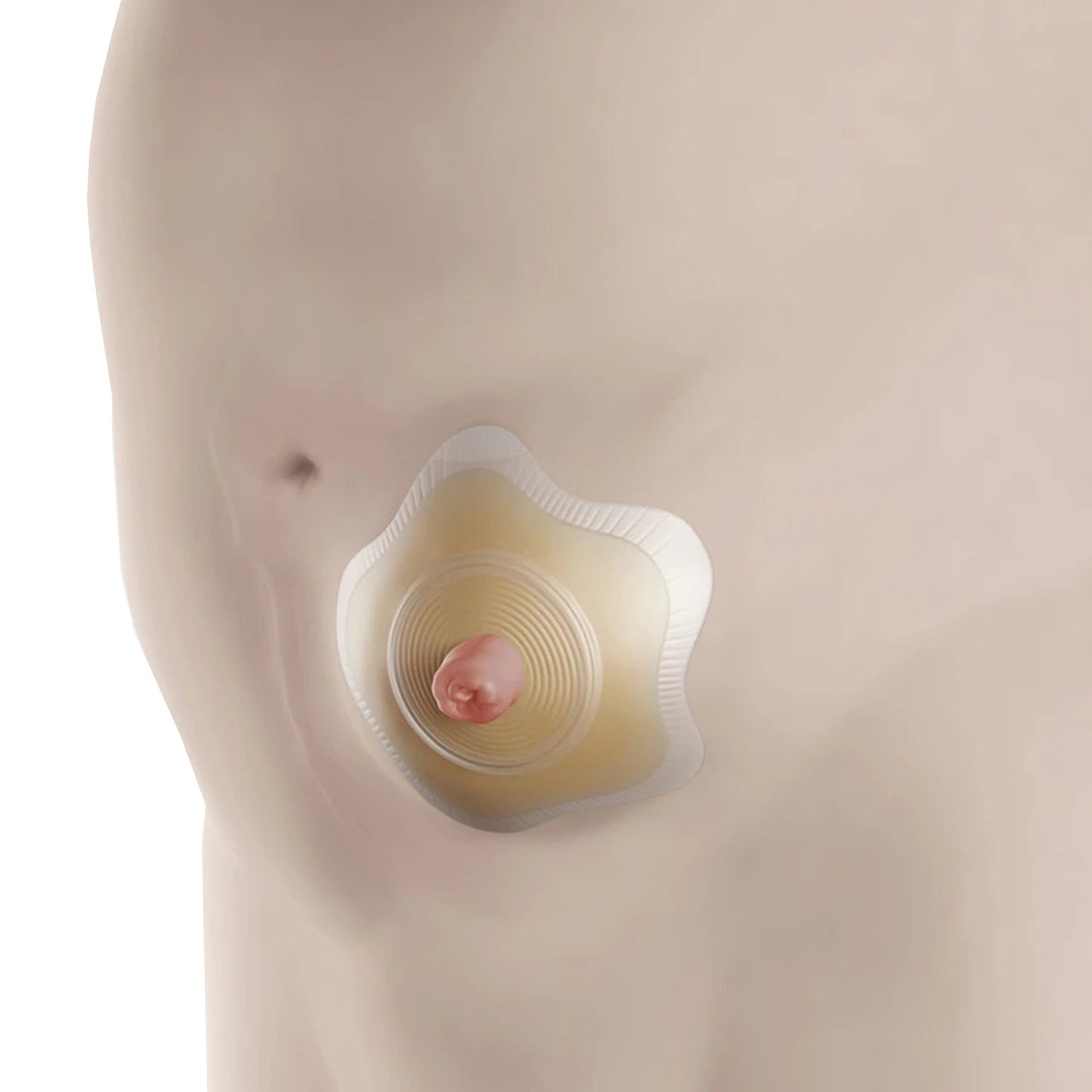 SenSura® Mio Convex Flip Ostomy Barrier Trim to Fit, Extended Wear Elastic Adhesive 50 mm Flange Red Code System 3/8 to 1-3/4 Inch Opening (1124396_BX)