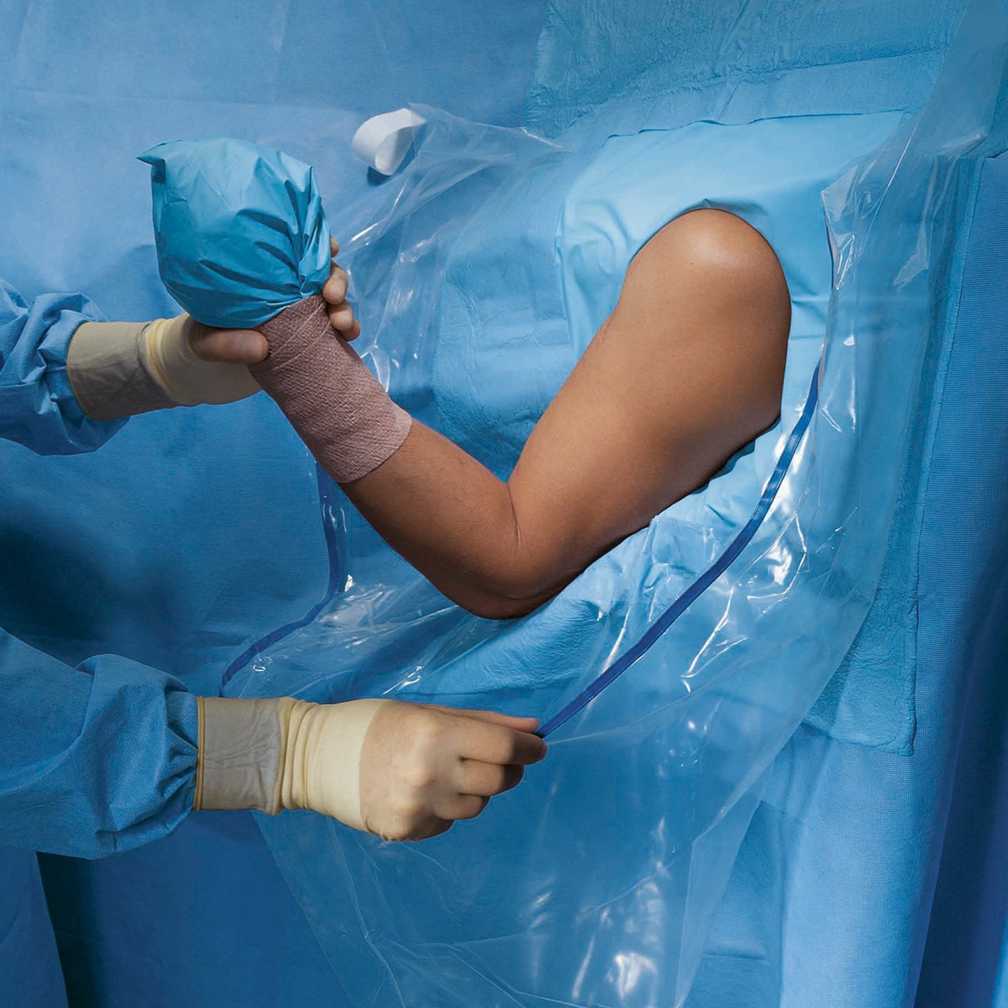 O&M Halyard Inc Orthopedic Drape Shoulder Arthroscopy Drape 160 W X 102 L Inch Sterile (472658_EA)