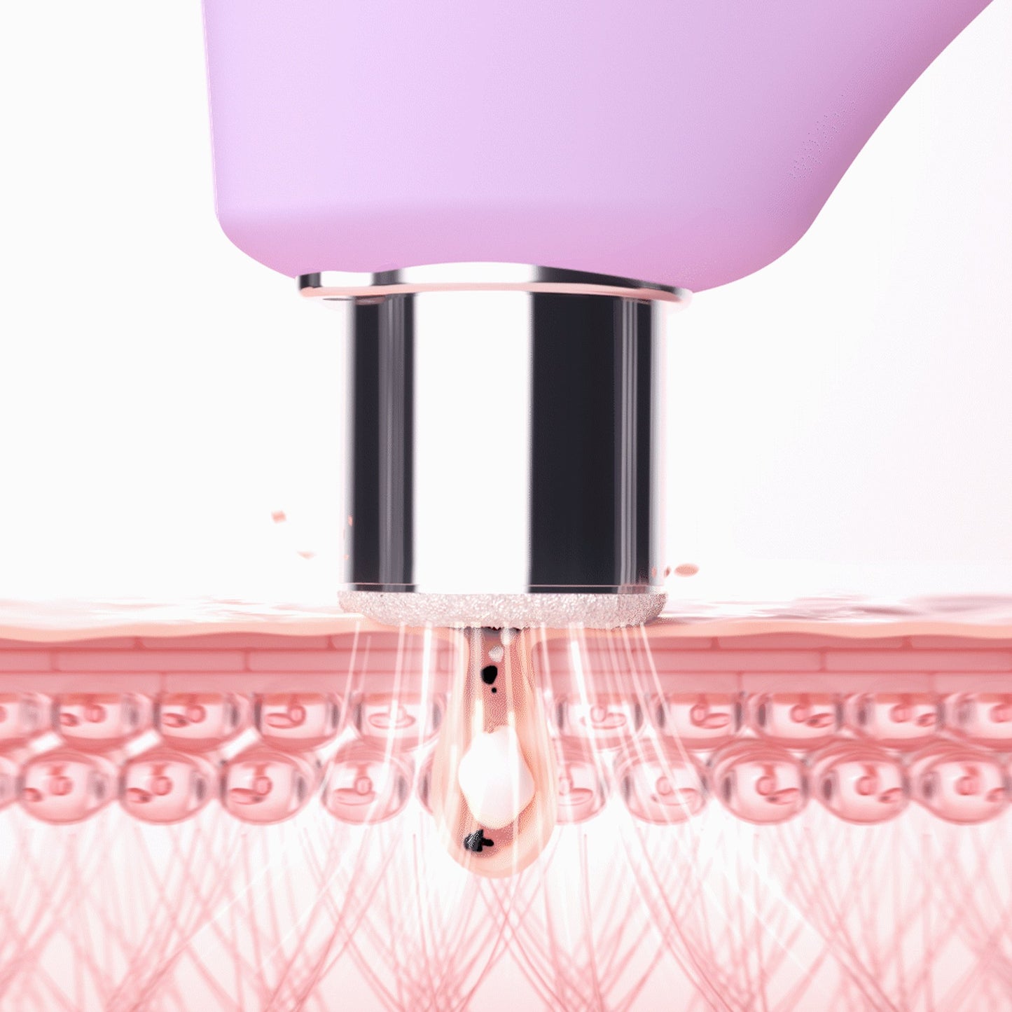 KIWI™ derma Diamond Microdermabrasion Pore Vacuum KIWI™ derma (1244547_EA)