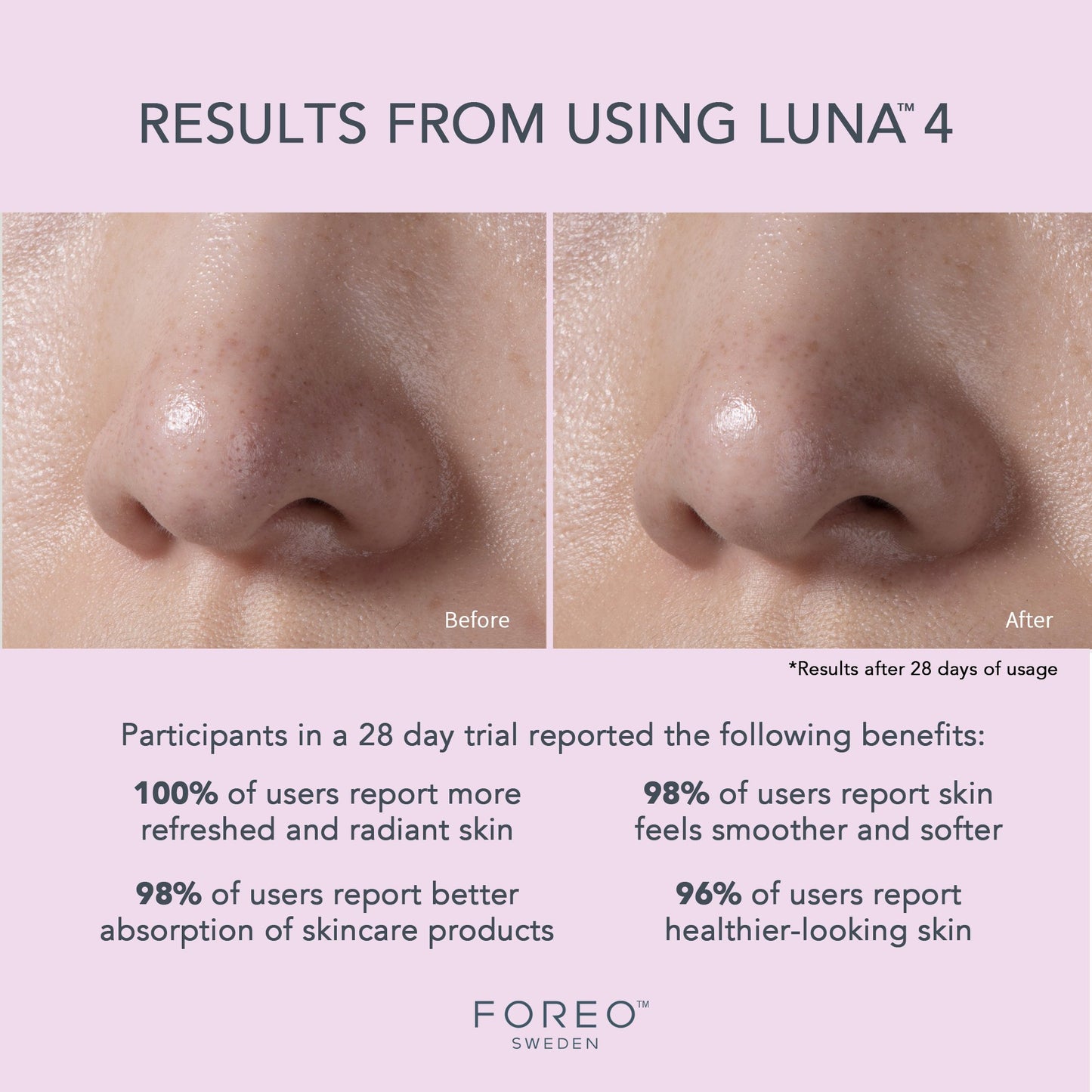 LUNA™ 4 Sensitive Skin Facial Cleansing Brush and Massage Device LUNA™ 4 Sensitive Skin (1244542_EA)
