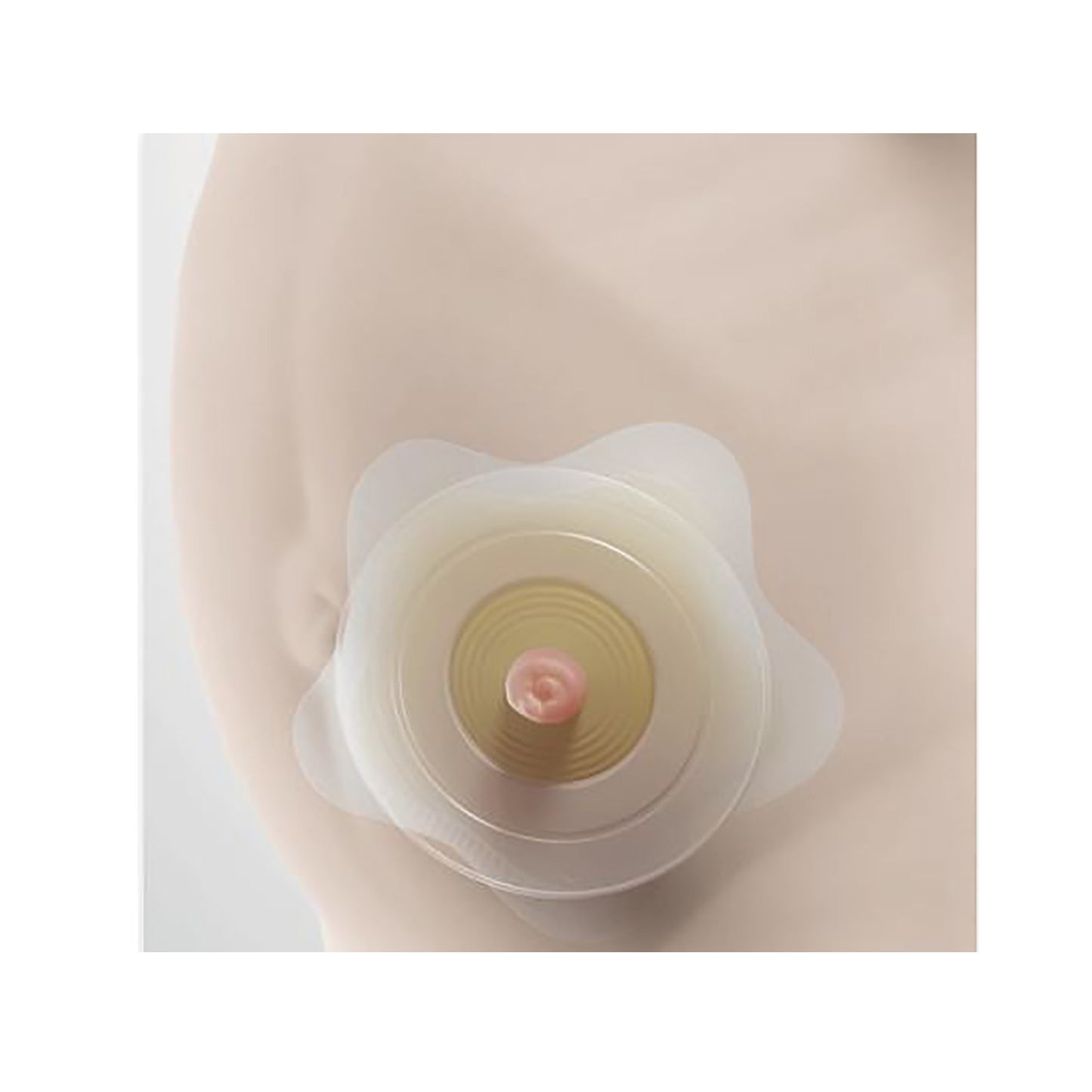 SenSura® Mio Kids Ostomy Barrier Trim to Fit, Standard Wear Adhesive Coupling Without Flange Purple Code System 0 to 1-1/16 Inch Opening (1124383_BX)