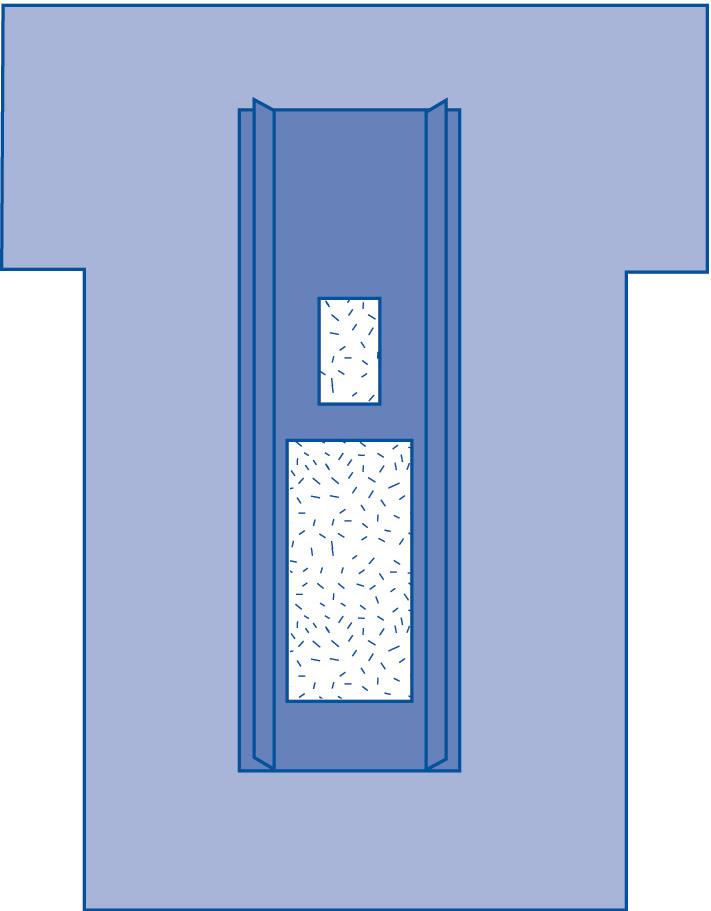 femoral-angiography-drape-with-pouch-sterile-8-cs-dynjp4004_1