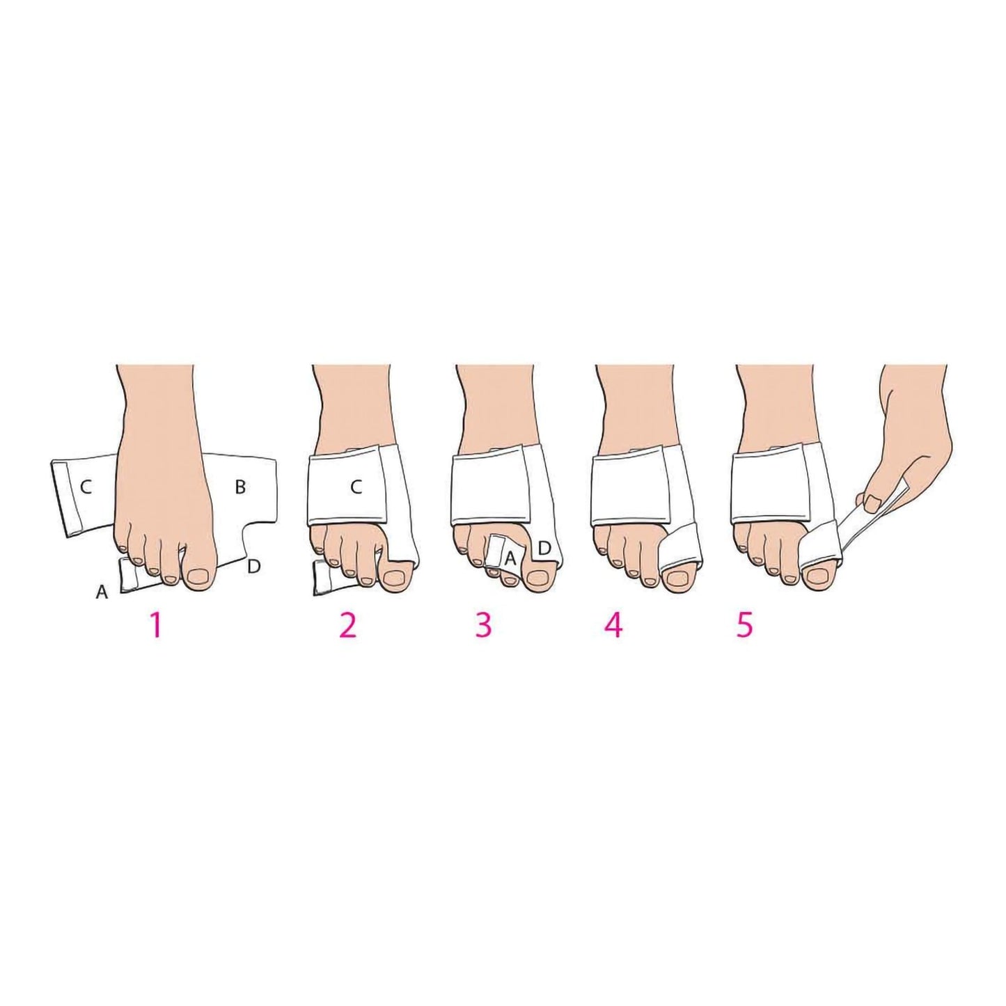 Softsplint™ Bunion Splint Medium Left Foot (890216_EA)