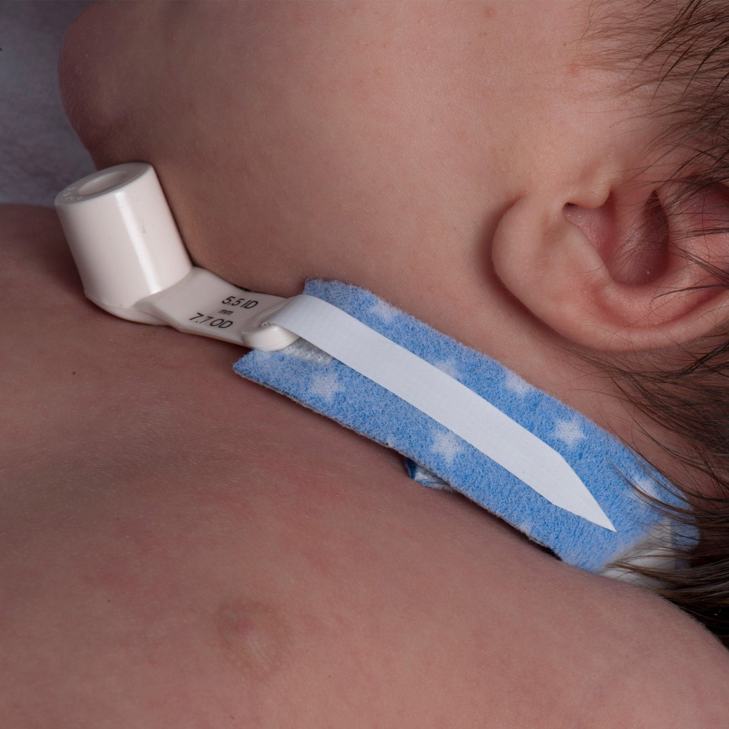 PediPrints® Tracheostomy Tube Holder 3/4 X 9 Inch Neonate (407376_EA)