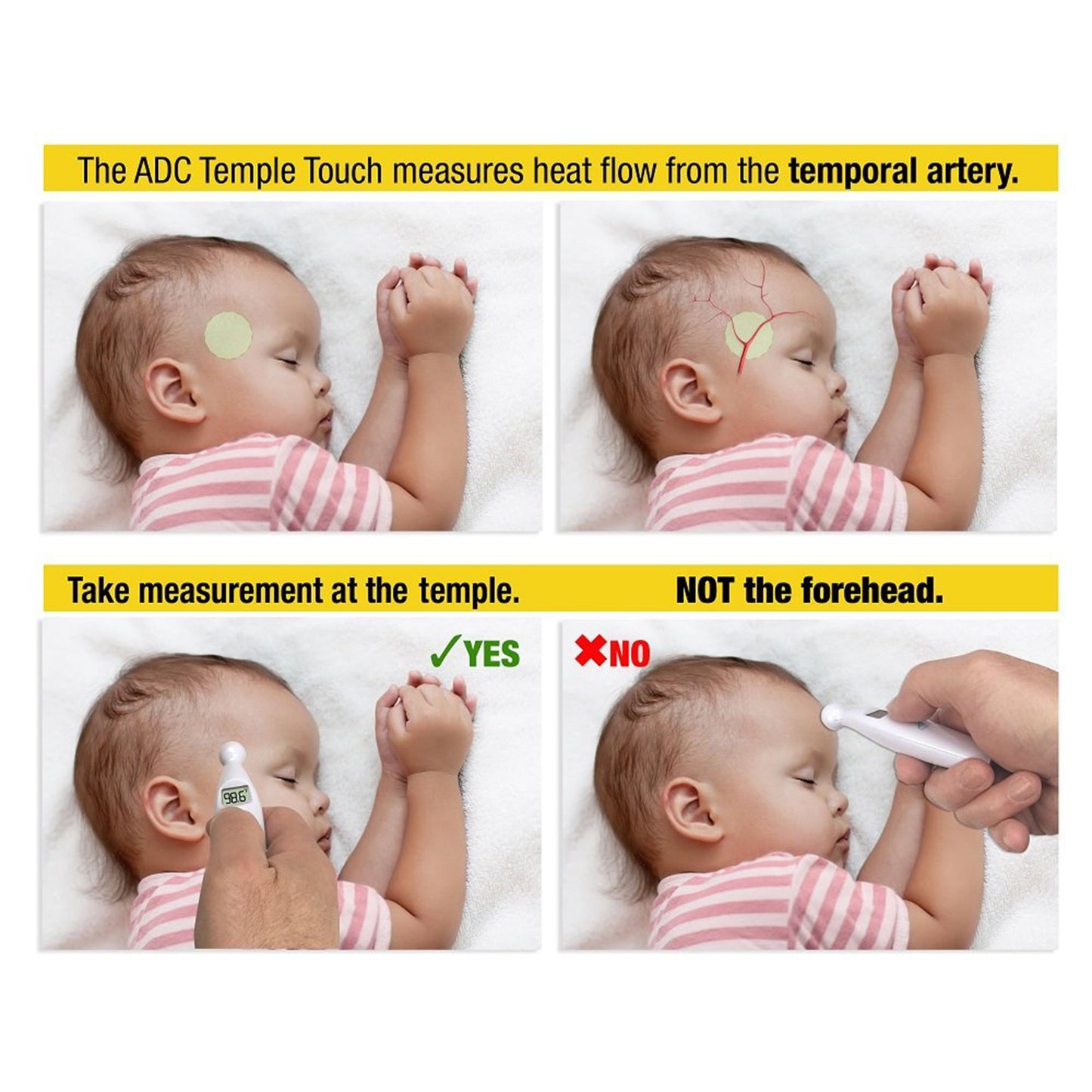 Adtemp™ 427 Temporal Contact Thermometer Temporal Probe Handheld (1241977_EA)