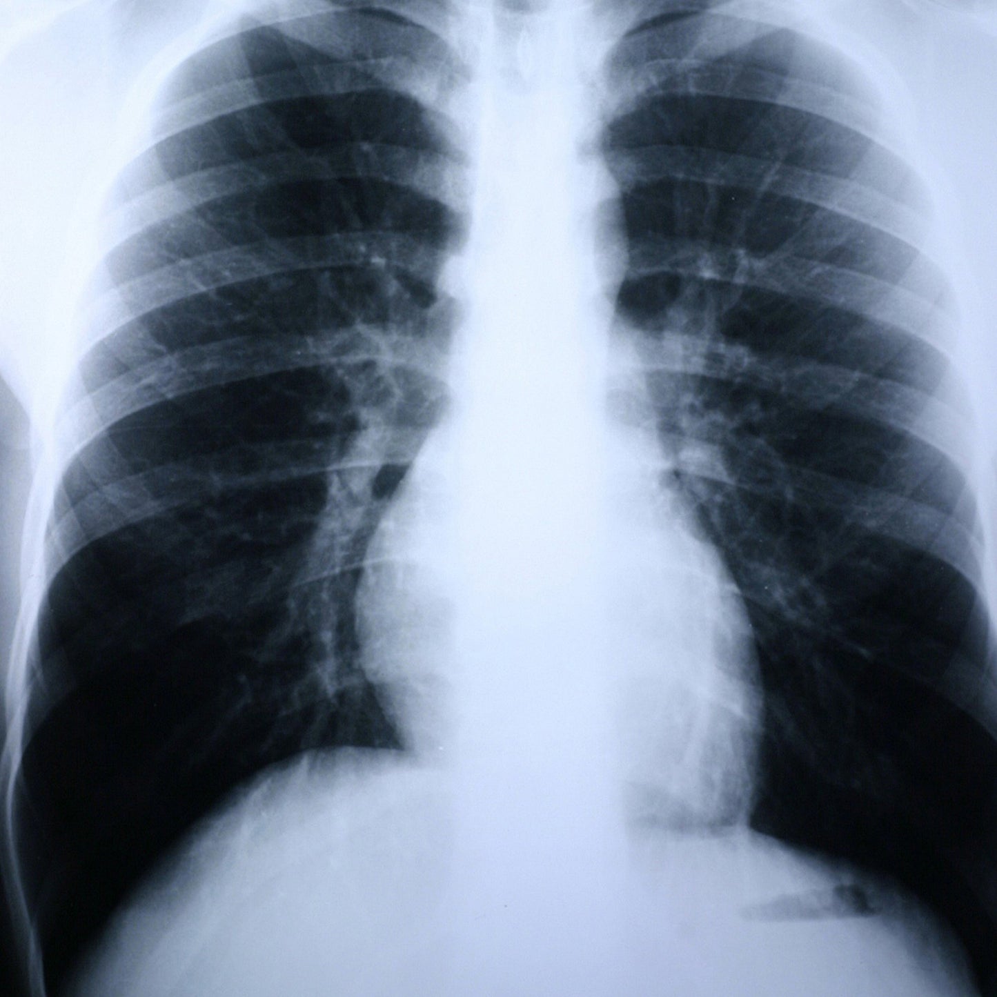 Clear Choice™ Performance X-Ray Film 8 X 10 Inch High Speed Blue Sensitive High (381332_BX)