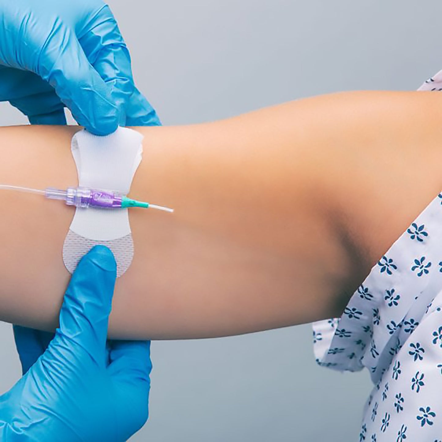 Grip-Lok® Catheter / Line Securement Device Grip-Lok® (1053885_EA)