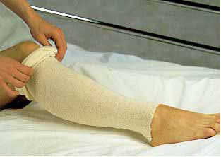 Albahealth® Stockinette Tubular 3 Inch X 25 Yard Cotton NonSterile (243650_EA)