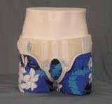 Alex Ortho Truss Small (851533_EA)