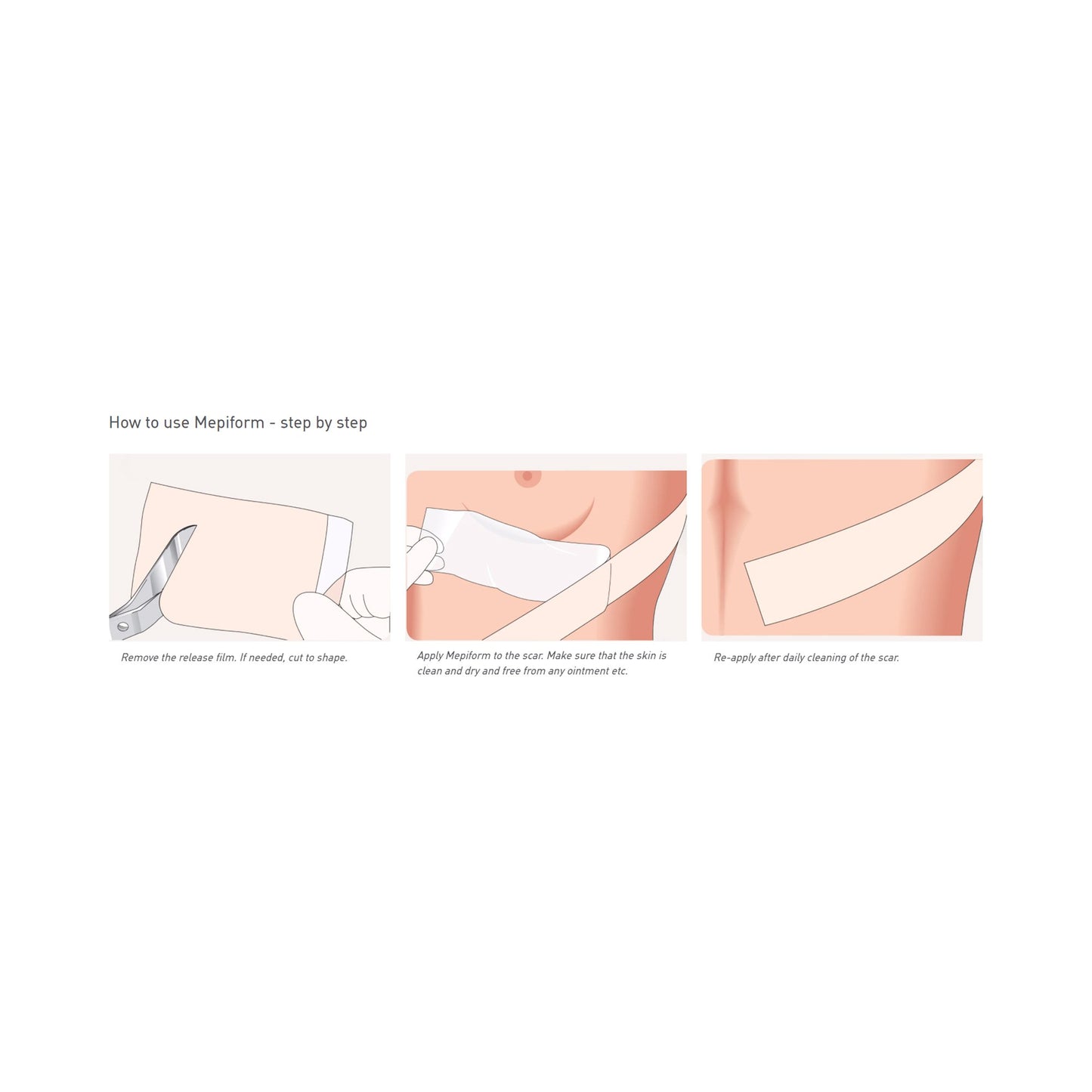 Mepiform® Silicone Sheeting 2 X 3 Inch Rectangle NonSterile (712213_BX)