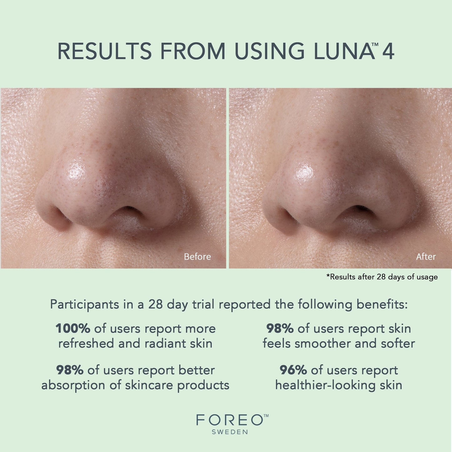 LUNA™ 4 Combination Skin Facial Cleansing Brush and Massage Device LUNA™ 4 Combination Skin (1244535_EA)