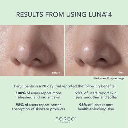 LUNA™ 4 Combination Skin Facial Cleansing Brush and Massage Device LUNA™ 4 Combination Skin (1244535_EA)