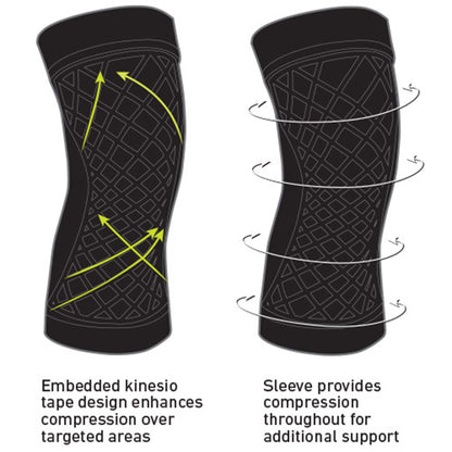 Spark Kinetic Knee Knee Support Large Without Fastening 16 to 18 Inch Knee Circumference Left or Right Knee (1128941_EA)