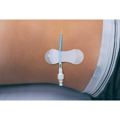Grip-Lok® Catheter / Line Securement Device Grip-Lok® (1084661_EA)