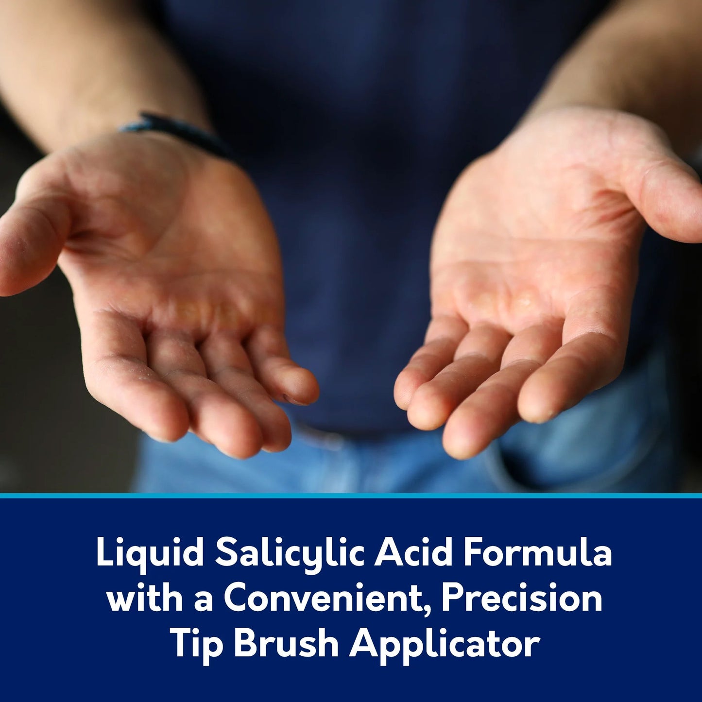 Compound W® Wart Remover 17% Strength Topical Solution 0.31 oz. (1218797_EA)