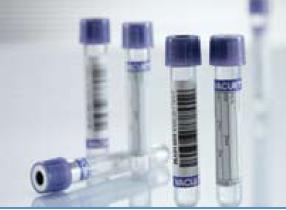 VACUETTE® Venous Blood Collection Tube K2 EDTA Additive 4 mL Pull Cap Polyethylene Terephthalate (PET) Tube (505509_CS)