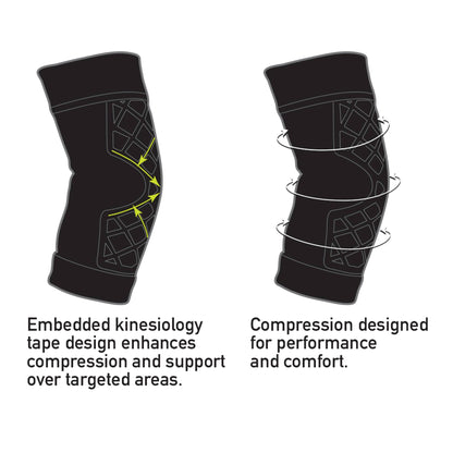 Spark Kinetic Elbow Support Large Pull-On Sleeve Left or Right Elbow 12-1/2 to 15 Inch Elbow Circumference Black (1228920_EA)