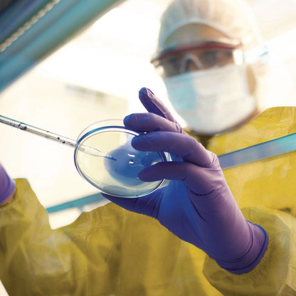 kleenguard-a70-chemical-spray-protection-smock-one-size-fits-most-yellow-25-carton-kcc09830_2