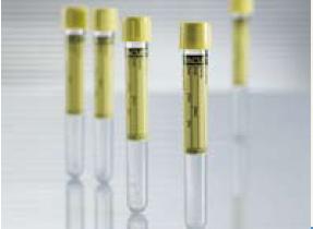VACUETTE® Urinalysis Tube Plain 6.5 mL Screw Cap Polyethylene Terephthalate (PET) Tube (507448_CS)