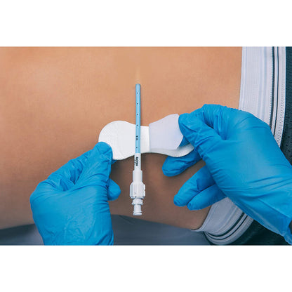 Grip-Lok® Catheter / Line Securement Device Grip-Lok® (1084661_EA)