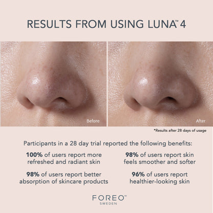 LUNA™ 4 Balanced Skin Facial Cleansing Brush and Massage Device LUNA™ 4 Balanced Skin (1244534_EA)
