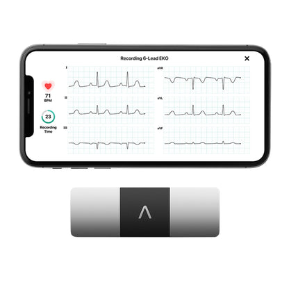 KardiaMobile® Electrocardiograph USB Connection Smart Phone Display Resting (1233883_CS)