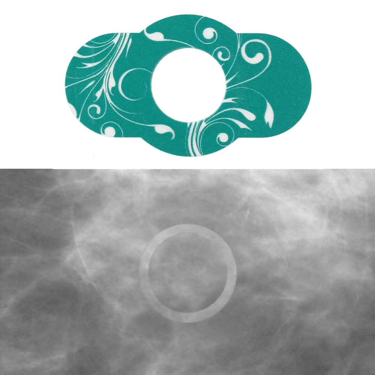 Spee-D-Line™ Swirl Collection™ Radiology Skin Marker Mole (1094942_BX)