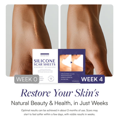 Skintensive® Silicone Skin Strip 1.6 X 3.5 Inch Rectangle NonSterile (1267994_CS)