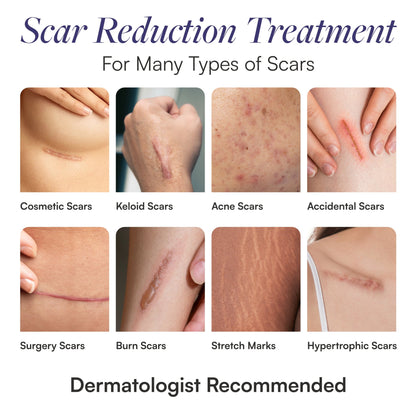 Skintensive® Silicone Skin Strip 1.6 X 3.5 Inch Rectangle NonSterile (1267994_CS)