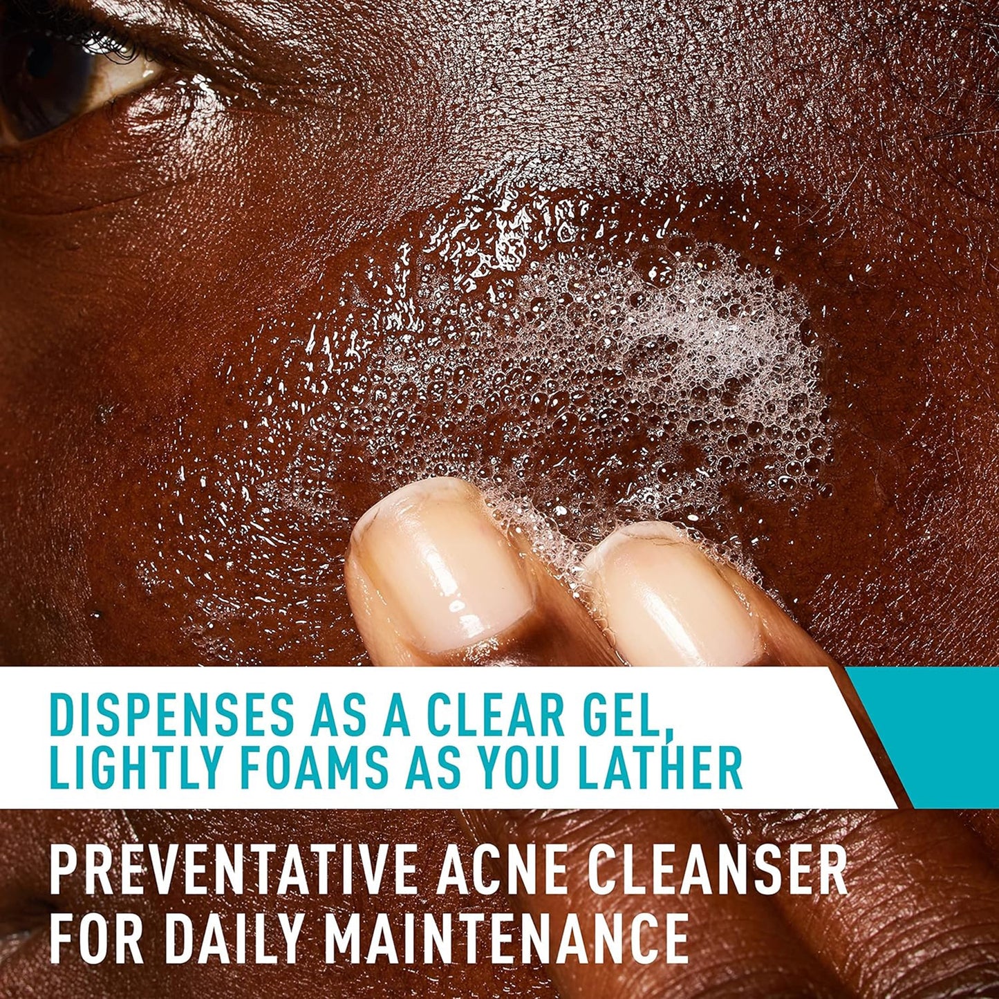 CeraVe® Acne Control Cleanser Acne Treatment 8 oz. Gel (1253462_EA)