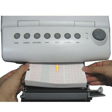 Edan® Recording Chart Paper Roll Red Grid (1051250_BX)
