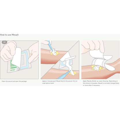 Mesalt® Sodium Chloride Impregnated Dressing Square 6 X 6 Inch / 3 X 3 Inch Folded Sterile (400463_CS)