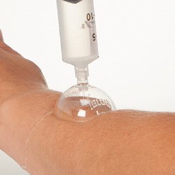 Health Care Logistics Wound Irrigation Shield Disposable, Plastic, Sterile (973944_EA)