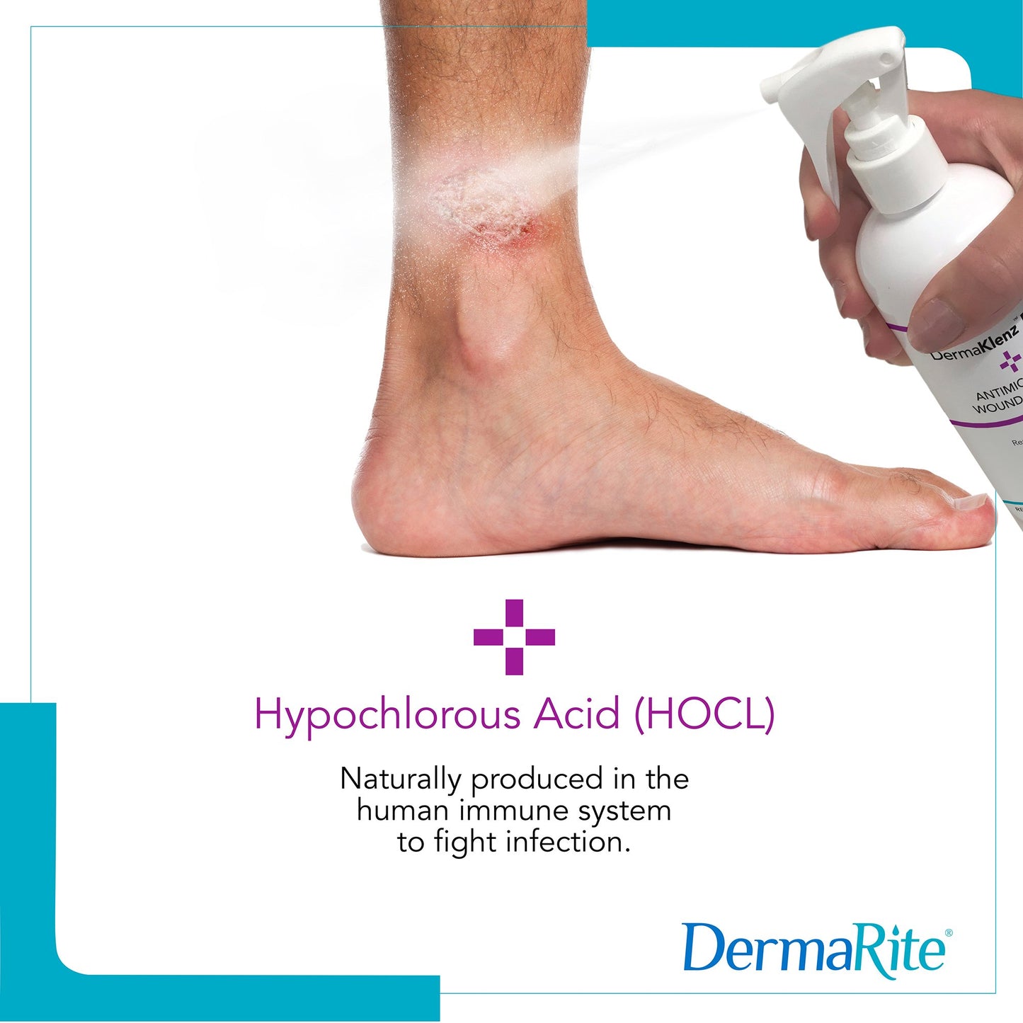 DermaKlenz™ Plus Wound Cleanser 8 oz. Spray Bottle NonSterile Antimicrobial (1256077_EA)