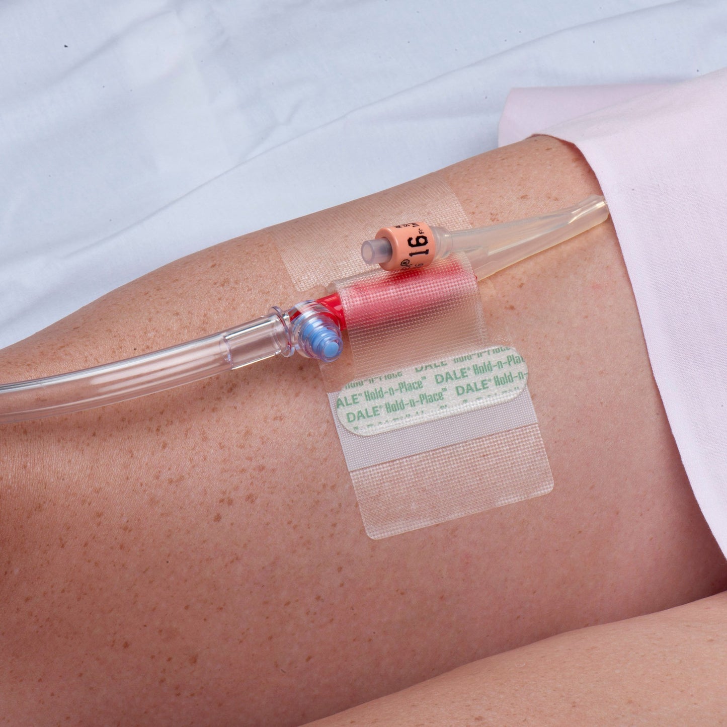 Hold-n-Place® Catheter Holder One Size Fits All, Adhesive Patch (697965_EA)