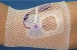 ProNet Elastic Net Retainer Dressing Tubular Gauze 8 Inch Length One Size Fits Most White Arm NonSterile (1136589_BG)