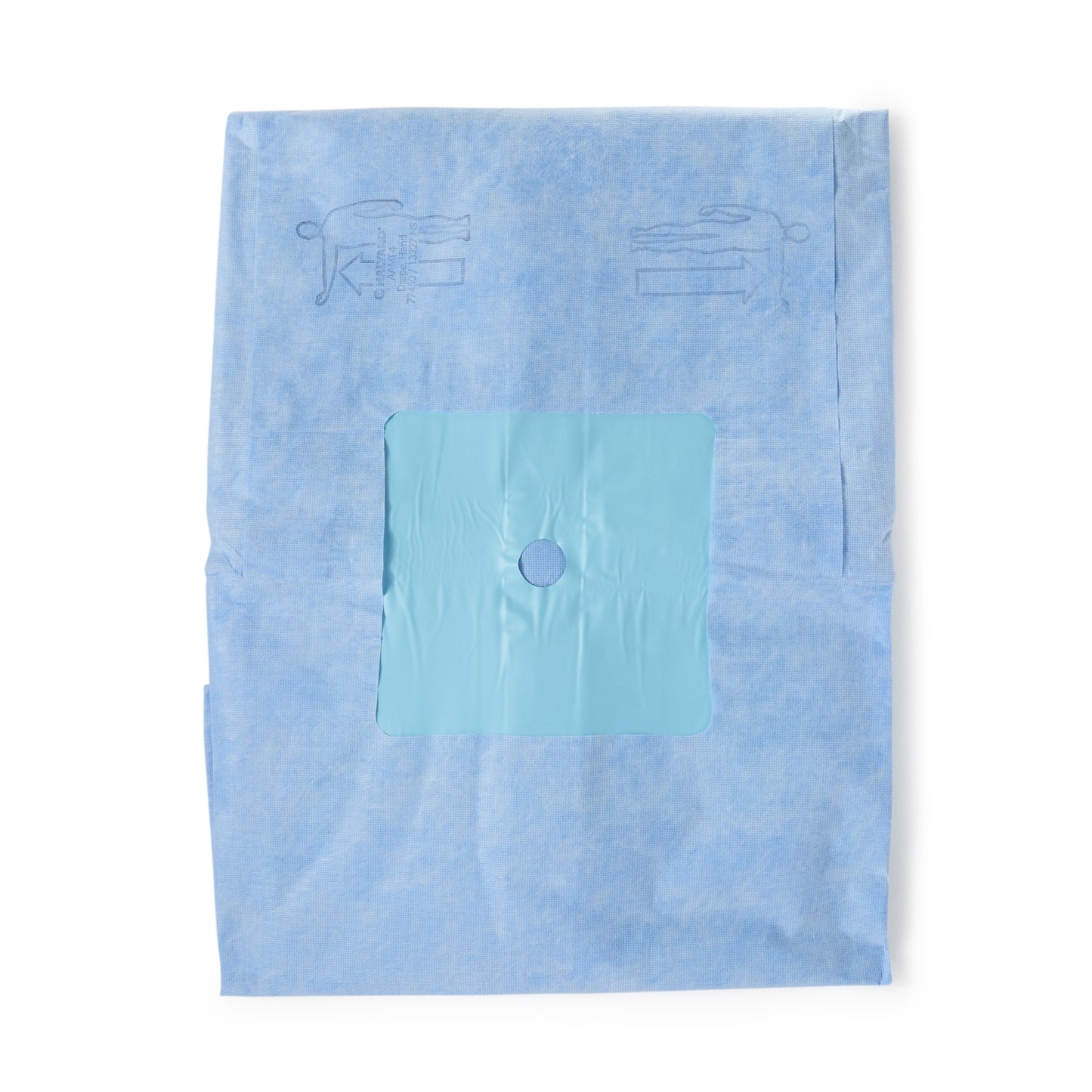 O&M Halyard Inc Orthopedic Drape Hand Drape 114 W X 142 L Inch Sterile (406665_CS)