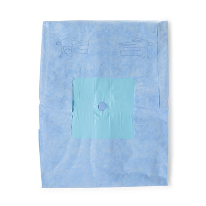 O&M Halyard Inc Orthopedic Drape Hand Drape 114 W X 142 L Inch Sterile (406665_EA)
