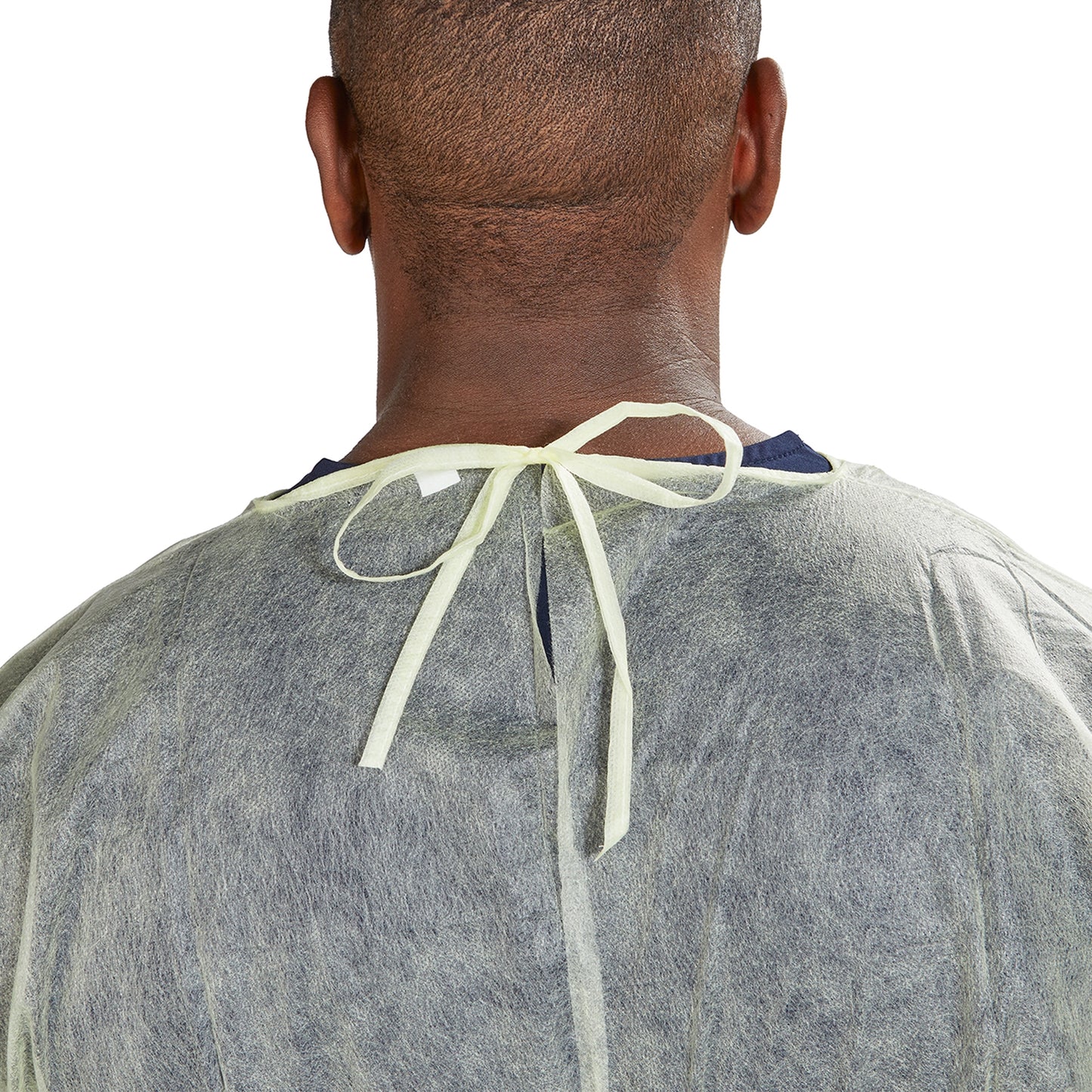 McKesson Protective Procedure Gown One Size Fits Most Yellow NonSterile Not Rated Disposable (1247973_CS)