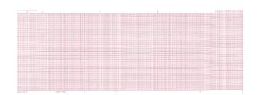Marquette™ Recording Chart Paper Roll Red Grid (1244827_BX)