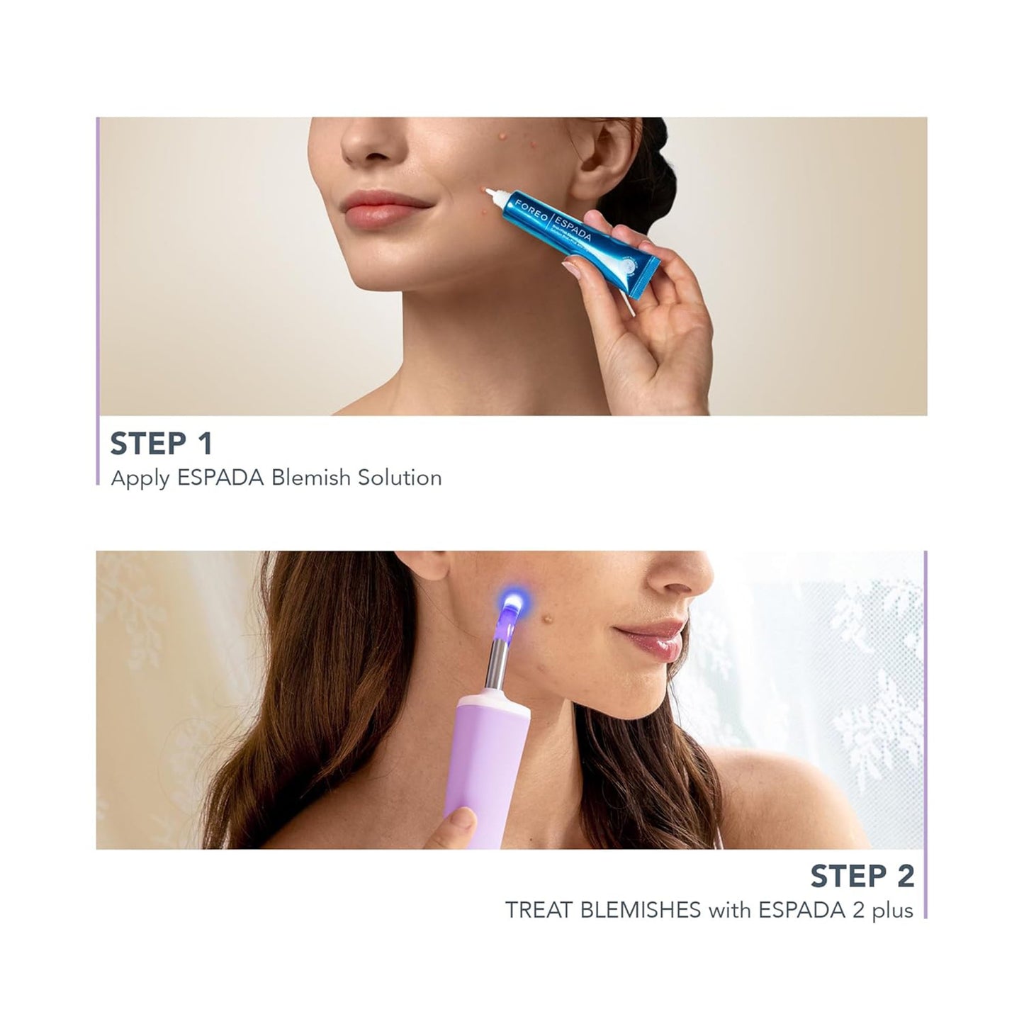 ESPADA™ 2 plus Acne Treatment ESPADA™ 2 plus (1259141_EA)